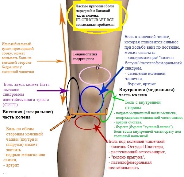 Zu welchem ​​Arzt Schmerzen im Knie zu behandeln?