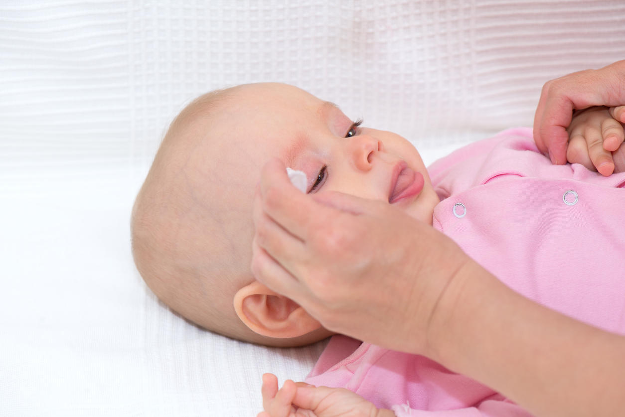 Rougeur de l'œil: causes et traitement chez l'adulte et l'enfant, photo