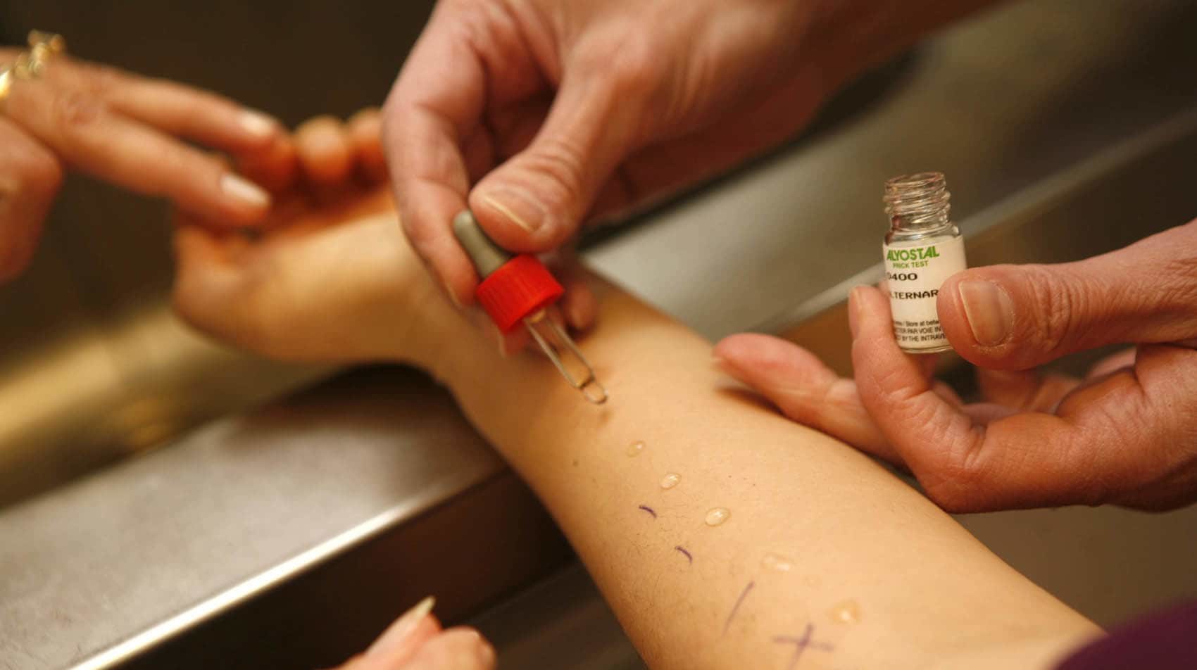 Allergia al lattice: cos'è, cause, sintomi, trattamento