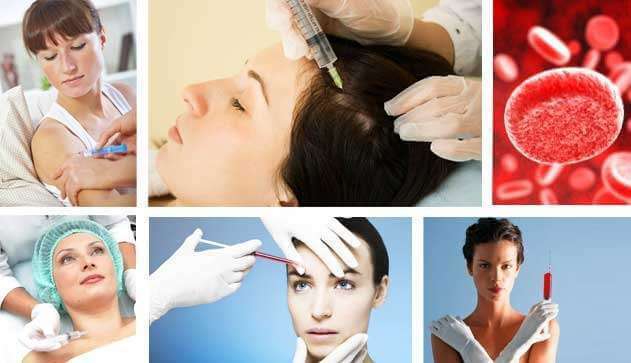 PRP-terapija kozmetika, značajke i prednosti Plazmolifting