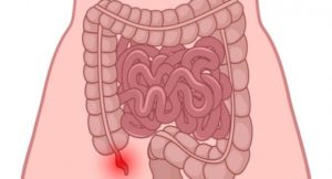 Appendice nel corpo umano