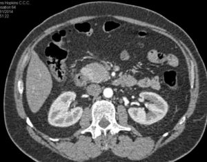 Organi su un'immagine tomografica