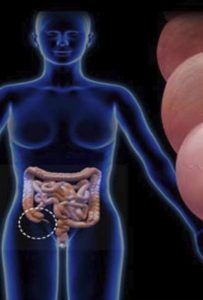 Appendice nel corpo umano