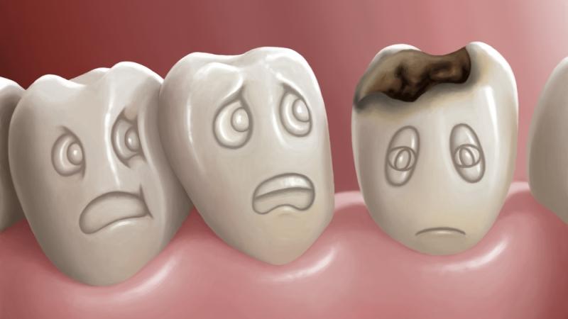 Forebyggelse af caries hos børn og voksne: de metoder og midler