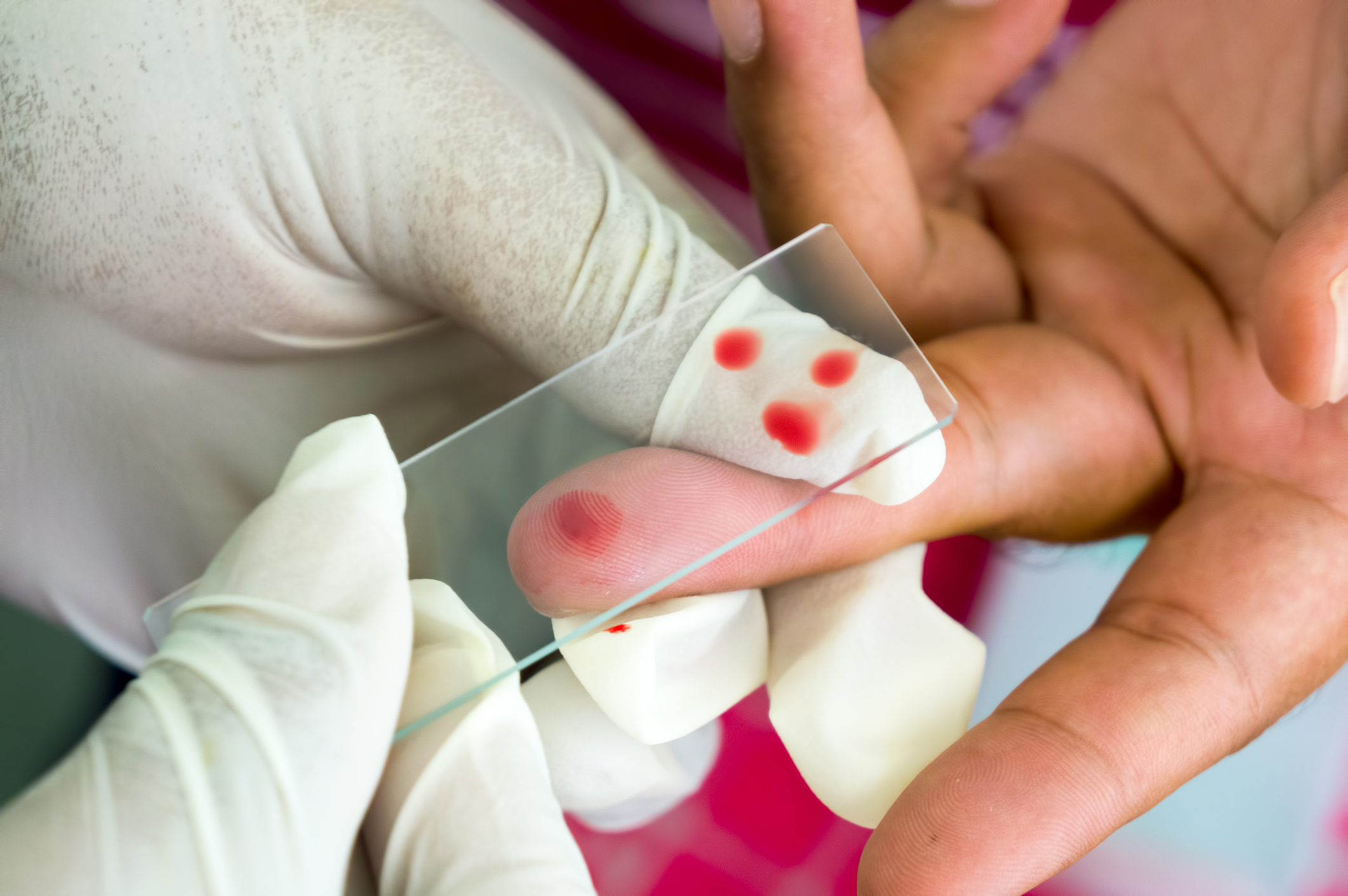 Hémogramme: la norme, le décodage des tests sanguins et de préparation pour l'analyse