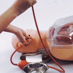 Grünes Erbrechen: Ursachen und Behandlung