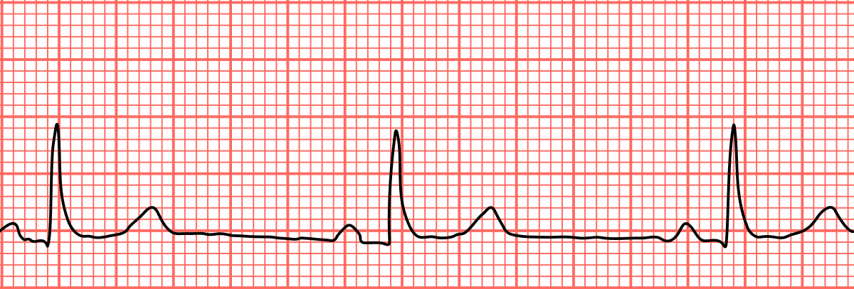 Heart rate: norm by age, table