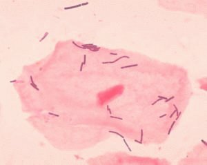 Microflore du nouveau-né