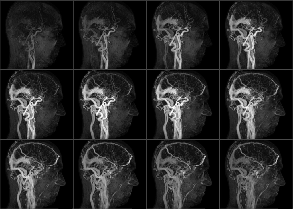Computer tomography of the brain: indications, contraindications and varieties