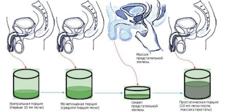 простата масажа: Како си, индикације, контраиндикације