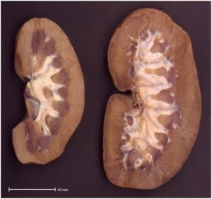 Hypertrophie der inneren Organe
