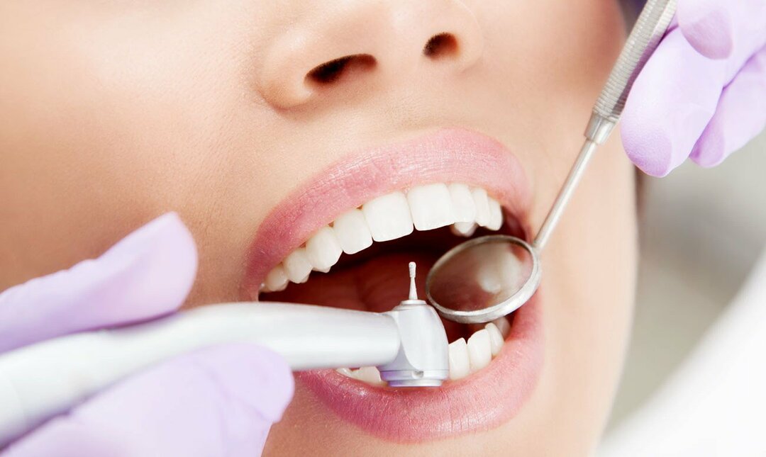 Zobārstniecība Preobraženkā. Kariesa ārstēšana