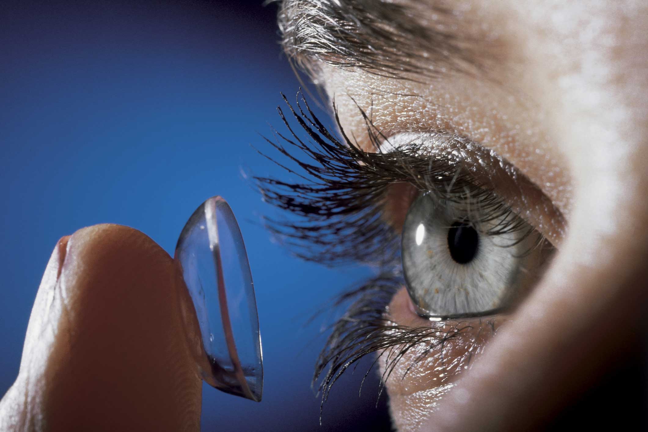 Astigmatism: what is it, causes, symptoms, treatment, prognosis