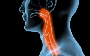 Dysphagie: Arten, Ursachen, Symptome, Behandlung und Grade