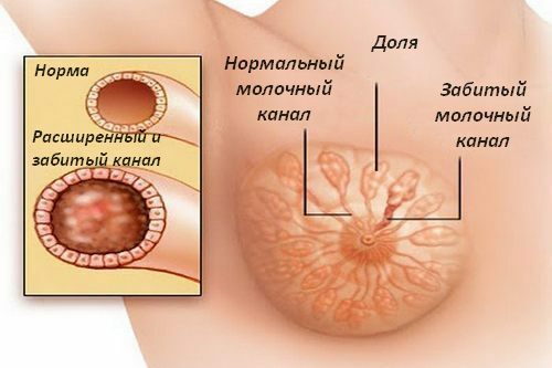 szoptatási problémák: hogyan lehet létrehozni a szoptatás?