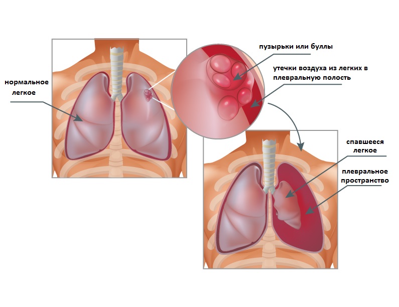 Presses in the middle of the sternum, it is hard to breathe like a lump in the throat, the reasons and what to do