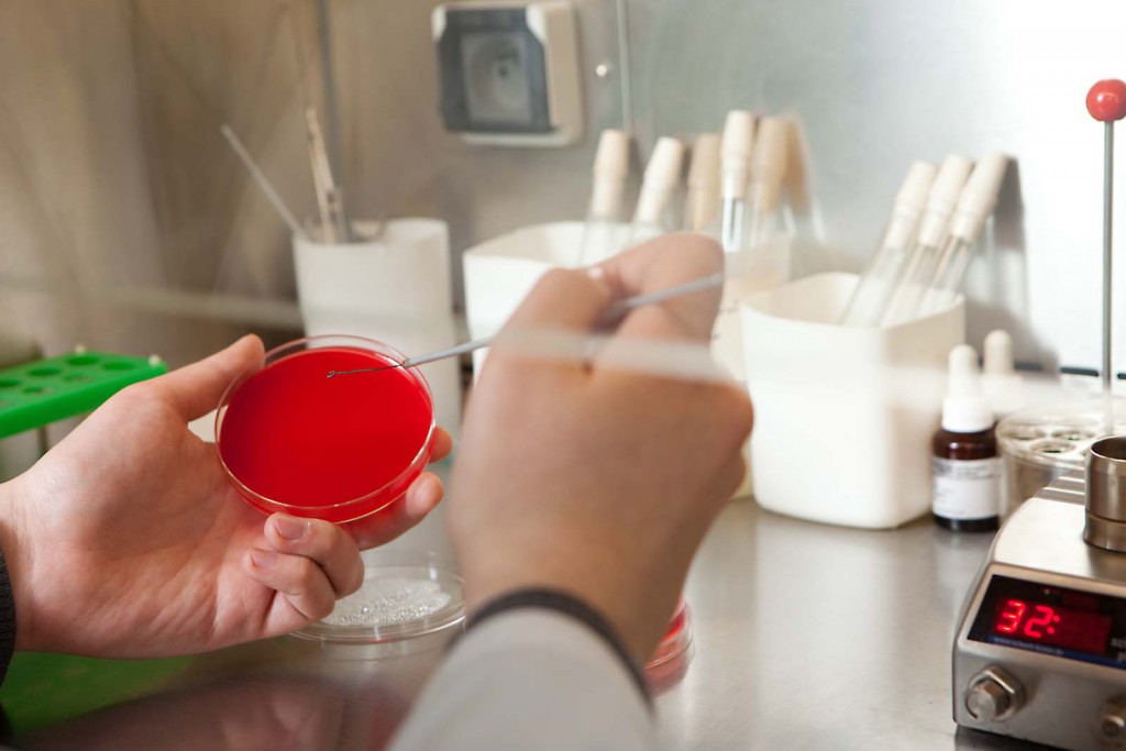 Bakposev urine: règles pour la préparation des tests de livraison et de décodage