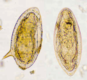 schistosomi