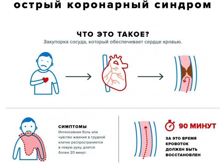 Ostry zespół wieńcowy: diagnostyka i opieka w nagłych wypadkach