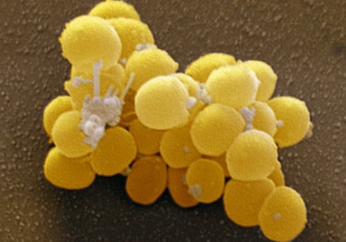 Stafilokokus aureus