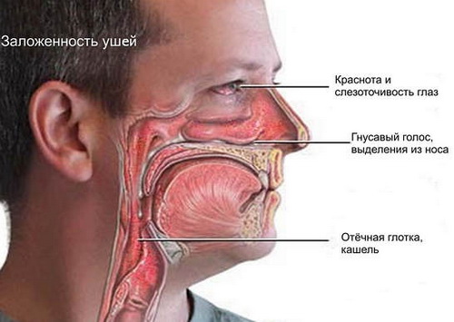 End at behandle allergisk rhinitis?