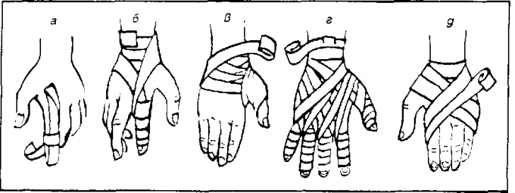 Verletzungen der Hand und Handgelenk: Erste-Hilfe