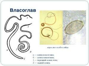 Vlasoglav (tricocefalia)