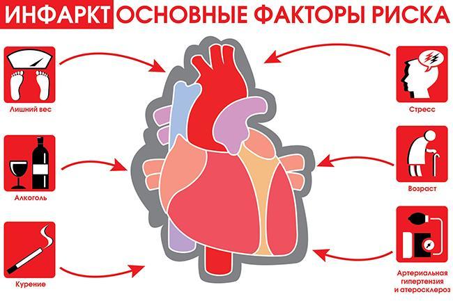 Südameinfarkti peamised riskifaktorid