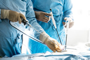Appendicite acuta: sintomi, diagnosi e pronto soccorso