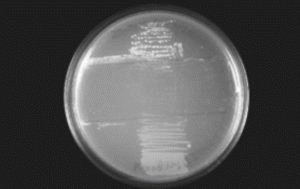 Dysbiose intestinale chronique: symptômes et traitement