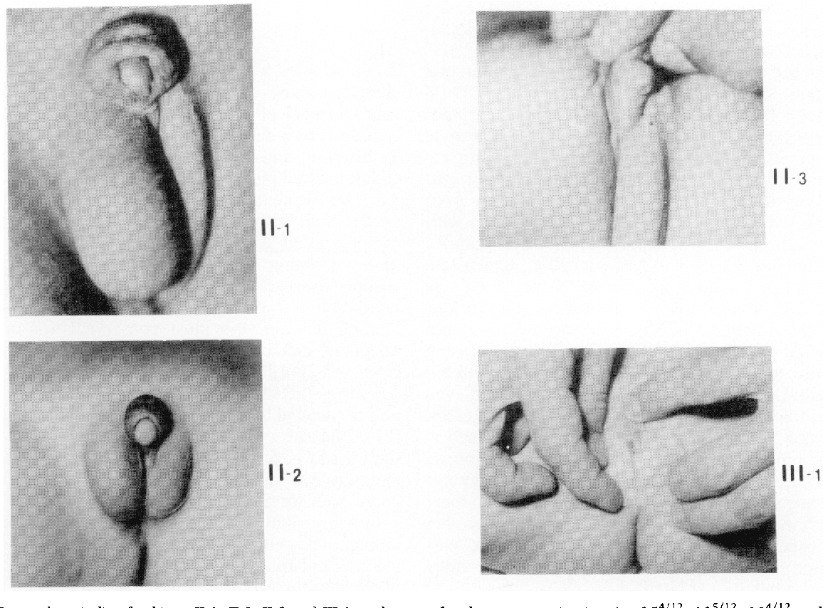 Morris-Syndrom: Was ist das, Ursachen, Symptome, Fotos, Behandlung, Prognose