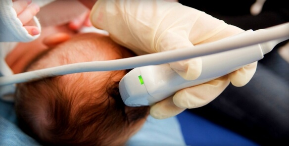 nouveau-nés cerveau de neurosonography
