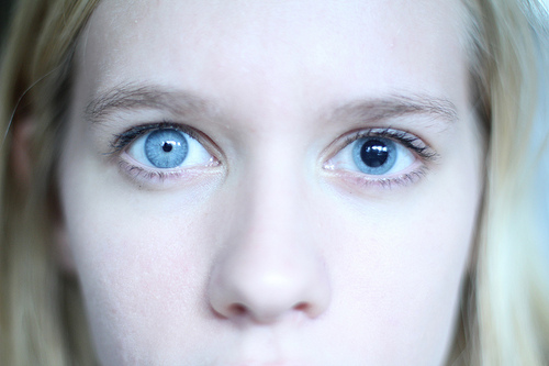 Anisocoria: what is it, causes, symptoms (photo), treatment