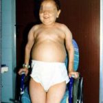 Gierke-Krankheit: Was ist das, Ursachen, Symptome, Behandlung, Prognose