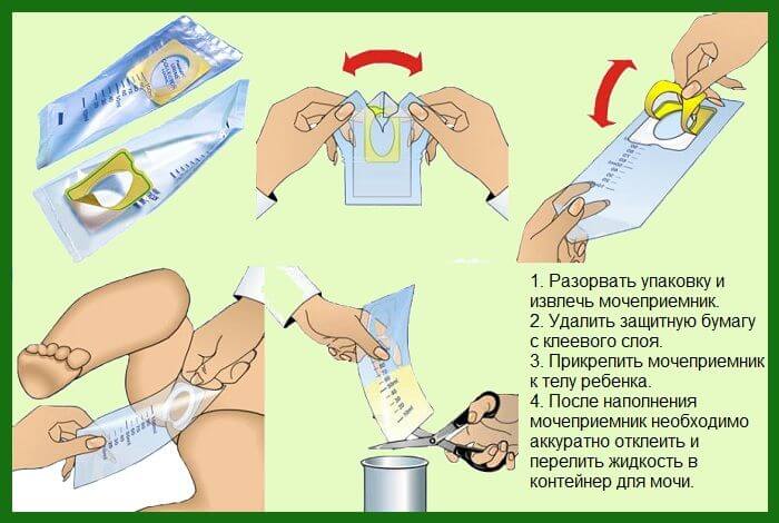 Comment prélever un échantillon d'urine?