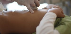 Ultrazvuk gastrointestinálního traktu dítěte