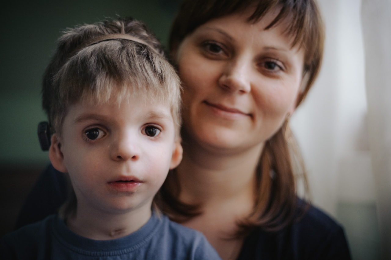 Treacher-Collins-Syndrom: Was ist das, Symptome, Behandlung, Prognose