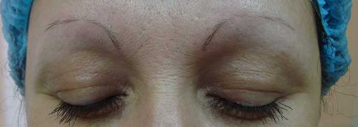 Permanent Make-up: Indikationen, Kontraindikationen, Technik, Nebenwirkungen, Korrektur