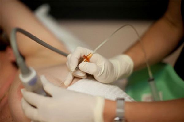 L'examen anatomopathologique: indications et décodage