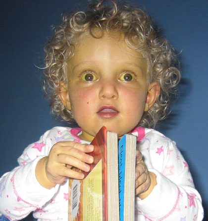 Alagille-Syndrom: Was ist das, Ursachen, Symptome, Behandlung