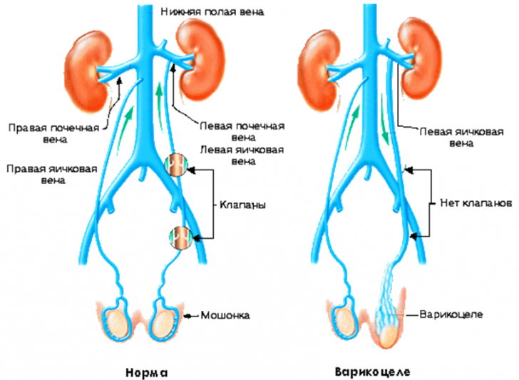 Nekrozoospermiya - causas, síntomas, tratamientos, y la probabilidad de concepción