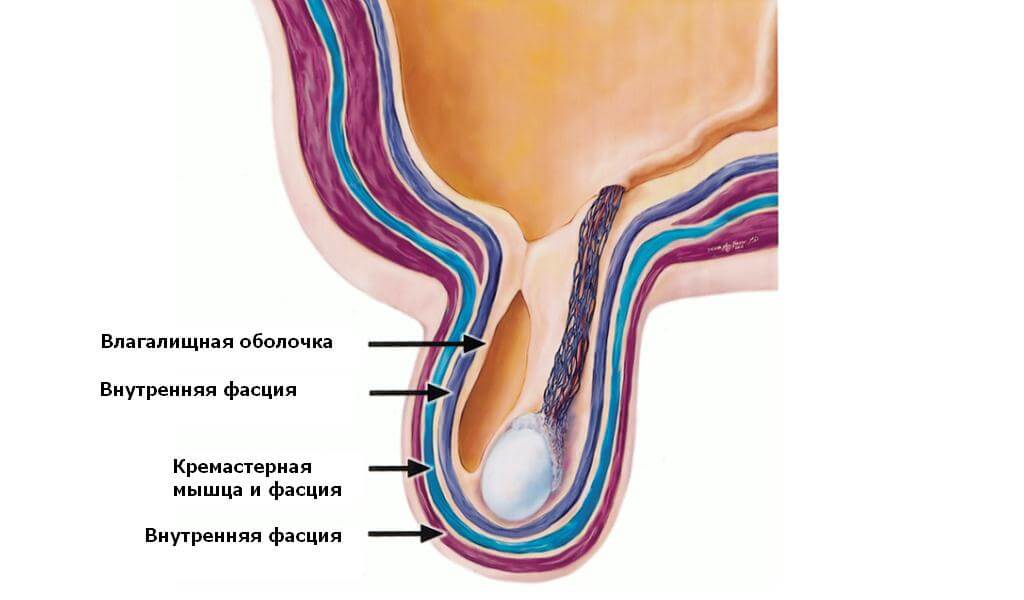 Testicular torsion: symptoms, treatment, operation