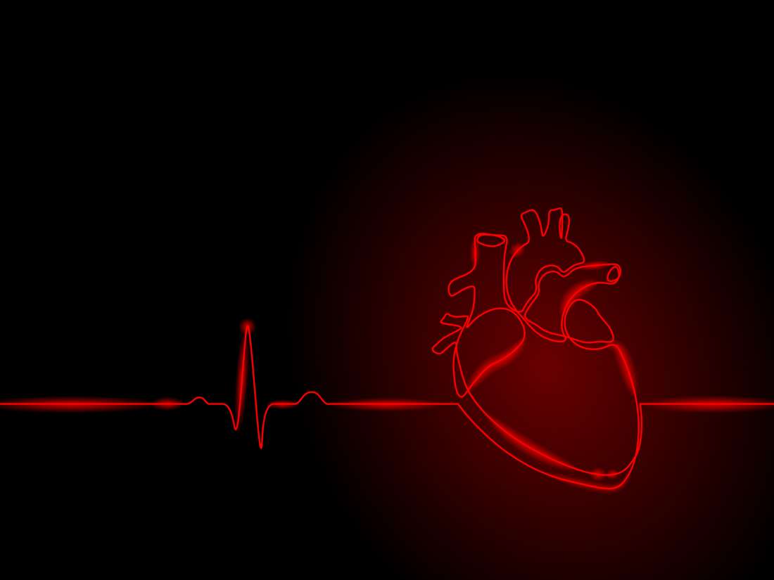 Arteriosklerose: Was ist das, Ursachen, Symptome, Behandlung, Vorbeugung