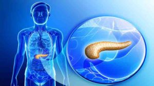 Menneskelig pancreatitis