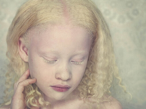 albín
