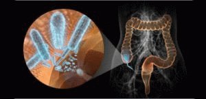 Quel médecin traite la dysbiose intestinale: qui contacter ?