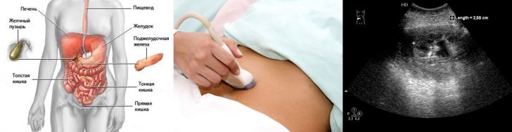 L'échographie de l'abdomen: les indications, la préparation, l'interprétation des résultats