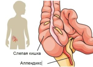 Appendiks er placeret i maven