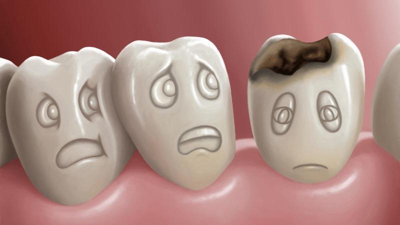 Behandling af caries under graviditeten: forebyggelse og årsagerne, konsekvenserne for fosteret
