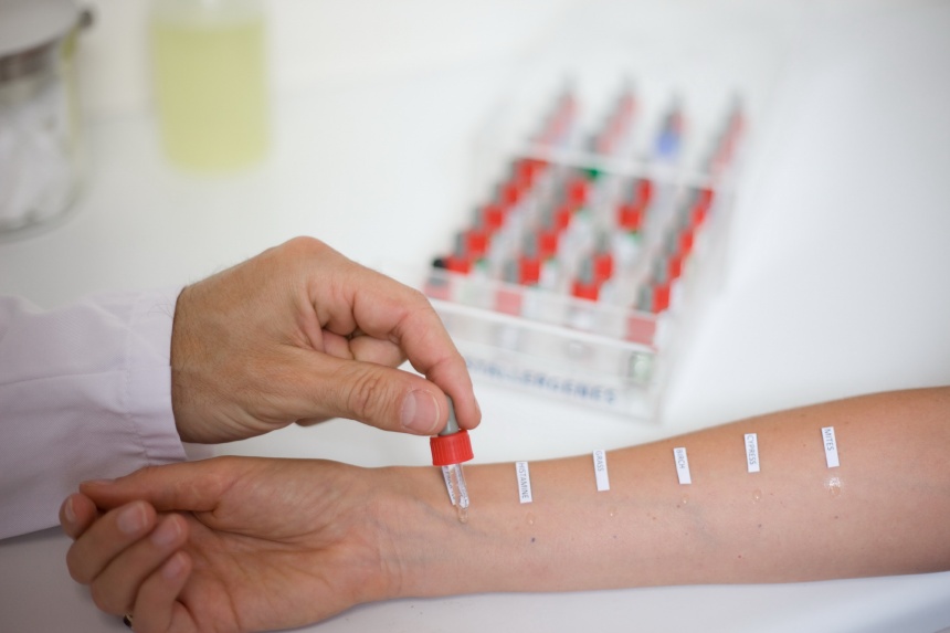 La fiebre del heno o fiebre del heno: síntomas y tratamiento
